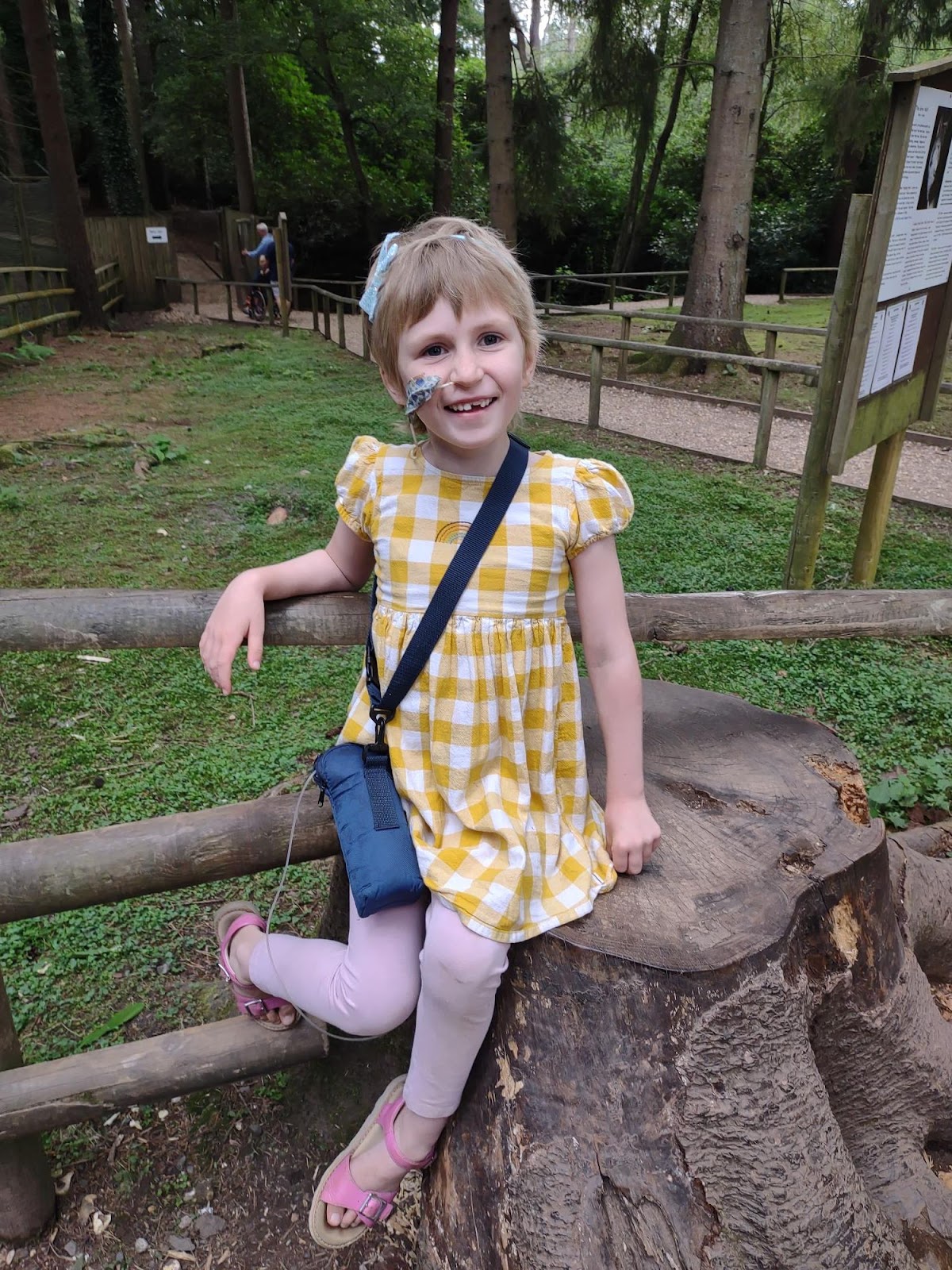 A young female neuroblastoma patient with a nasogastric tube smiling and standing by a tree stump