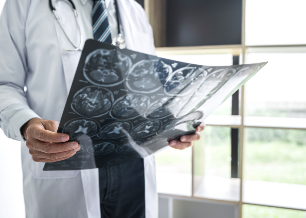 Doctor Hands Holding Patient Brain X-Ray Film before Treatment