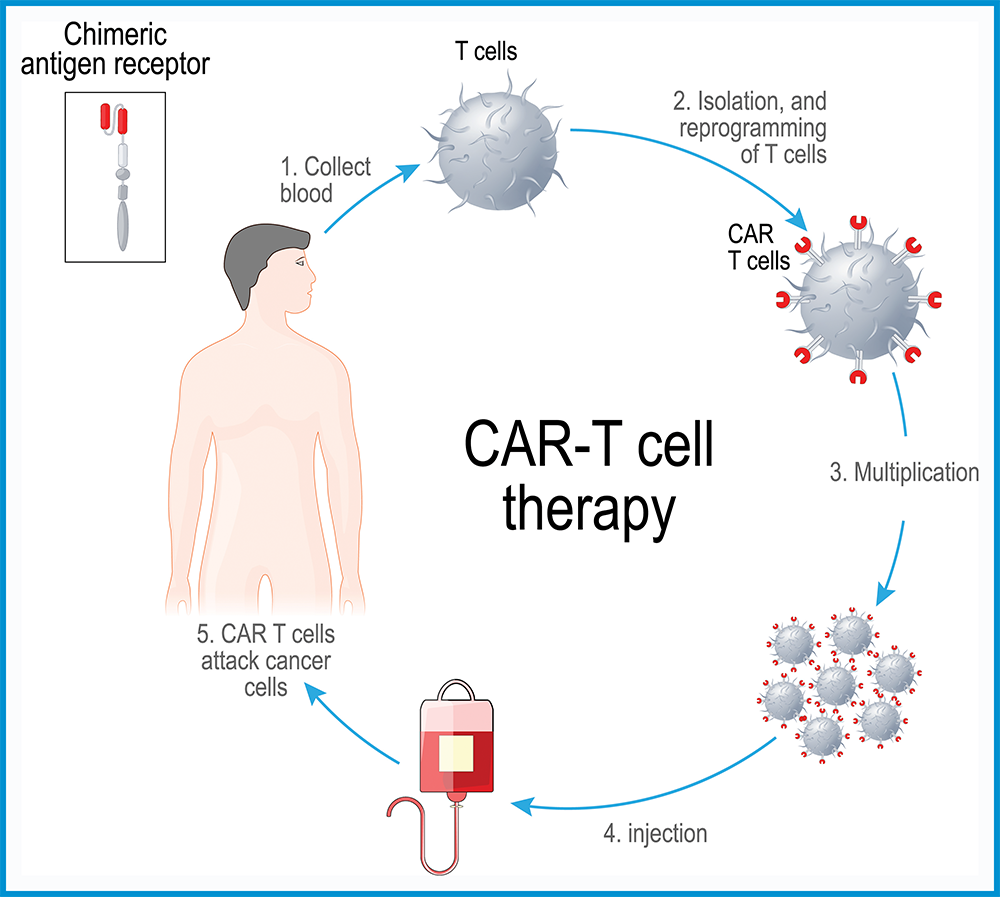 How do you decide?' Cancer patients die waiting for CAR-T therapy